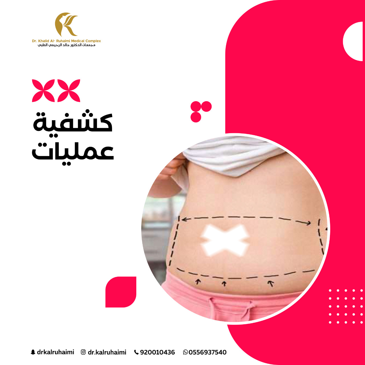 تقويم الاسنان نقداً